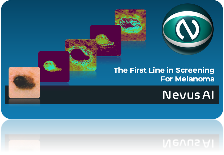 Nevus AI