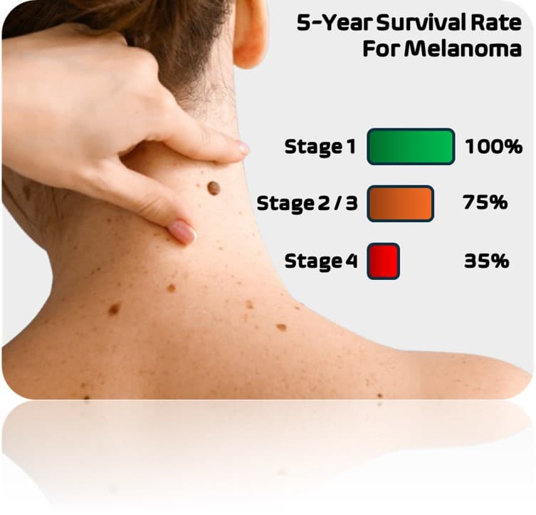 Demonstration of the Nevus AI app.