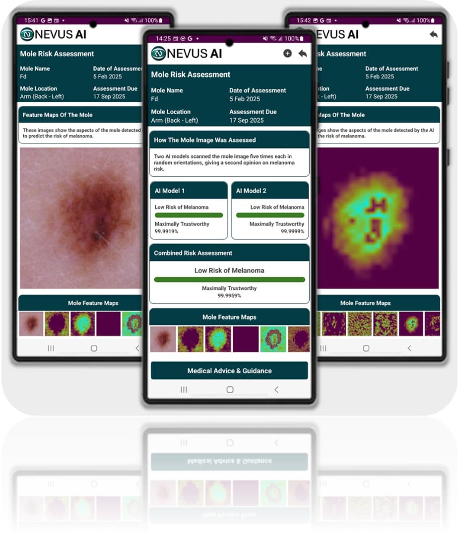Nevus AI