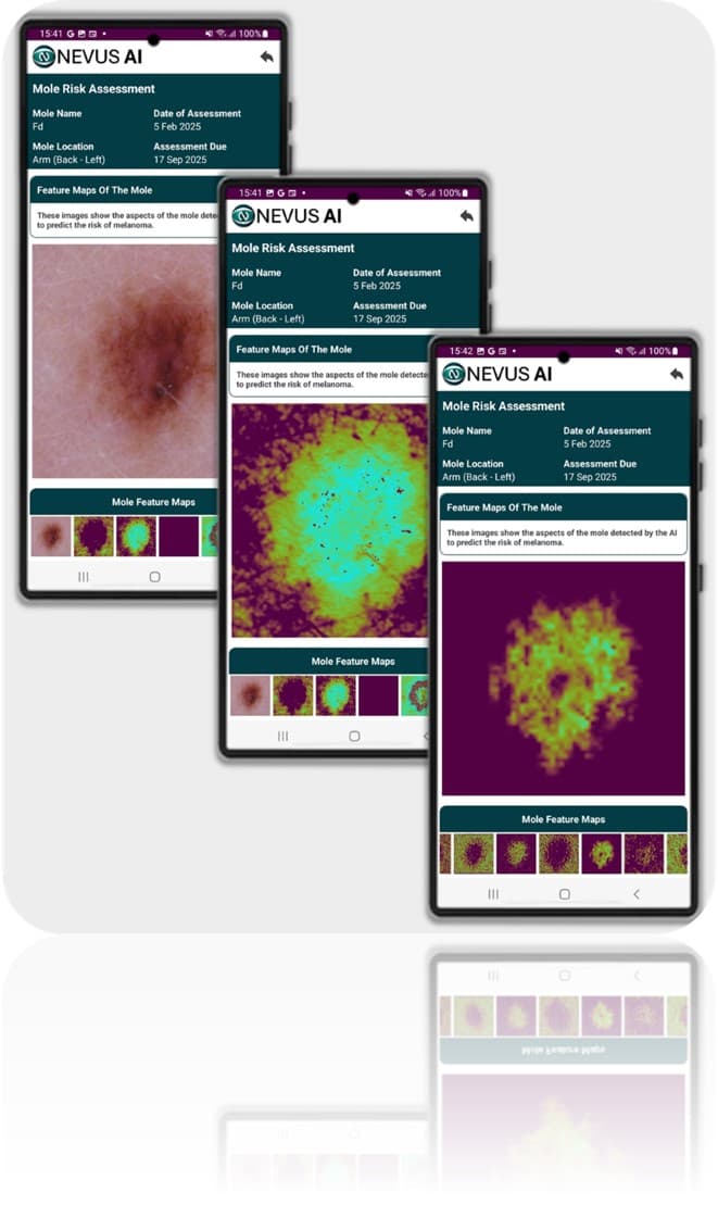 Nevus AI feature maps, peaking inside the AI model.