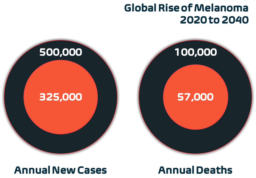 The global rise of melanoma between 2020 & 2040